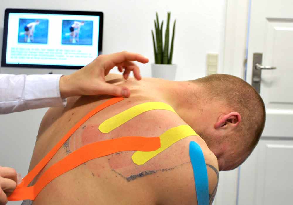 Kinesio Bantlama